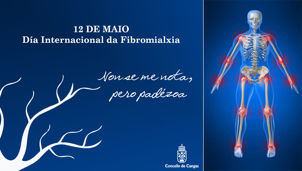 Día Internacional da Fibromialxia